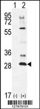 TSSK4 Antibody (C-term)