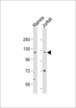 GIGYF1 Antibody (Center)