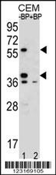 MNDA Antibody (N-term)