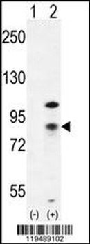 CTNB1 Antibody (C-term)