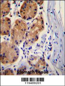 CTNB1 Antibody (C-term)
