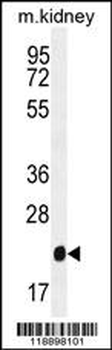 GPX3 Antibody (Center)