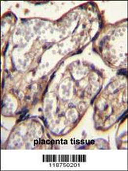 IGF2 Antibody (Center R54)
