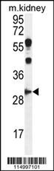 CCNG1 Antibody (C-term)