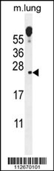 ECOP Antibody (Center)