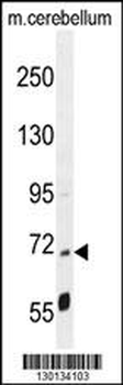 LRRC68 Antibody (N-term)