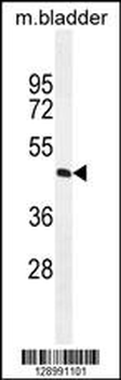 PPAPDC1A Antibody (N-term)