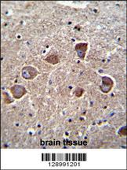 PPAPDC1A Antibody (N-term)