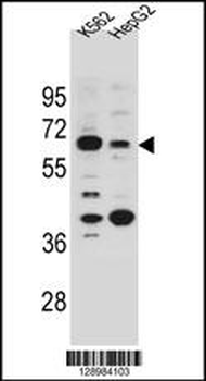 NHEDC1 Antibody (N-term)