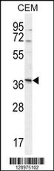 NXPH4 Antibody (C-term)