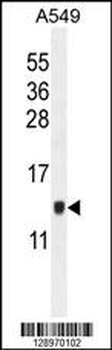 KTAP2 Antibody (C-term)