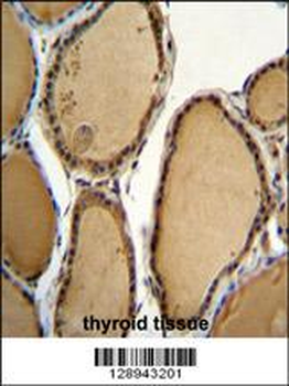KLRAQ1 Antibody (Center)