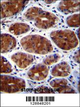 CPSF3L Antibody (N-term)