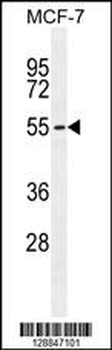 PMPCA Antibody (C-term)