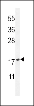 PLA2G2D Antibody (C-term)