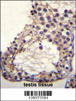 OTOA Antibody (N-term)