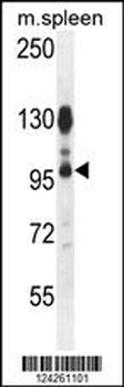ACAP1 Antibody (N-term)