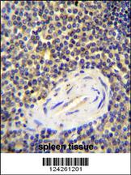 ACAP1 Antibody (N-term)