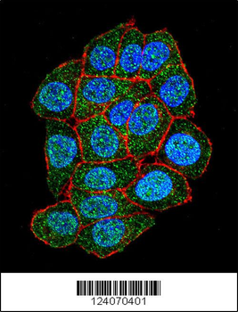 ASXL1 Antibody (Center)