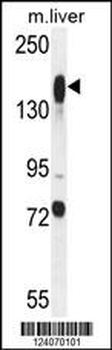 ASXL1 Antibody (Center)