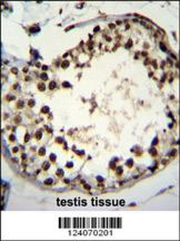 ASXL1 Antibody (Center)