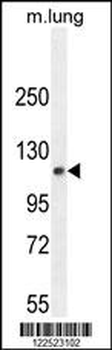 PHF12 Antibody (C-term)