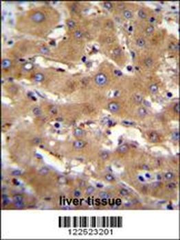 PHF12 Antibody (C-term)