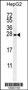 IRGM Antibody (C-term)