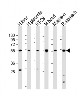 HTR2B Antibody (C-term E423)