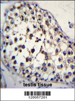 FUT8 Antibody (Center)