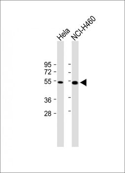 FGL2 Antibody (C-term)