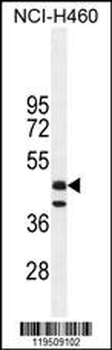 FGL2 Antibody (C-term)