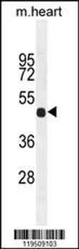FGL2 Antibody (C-term)