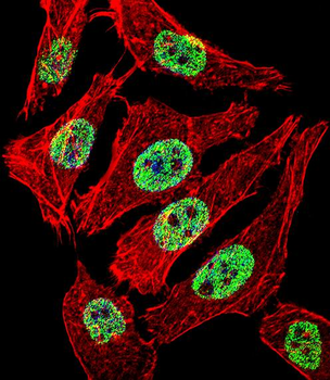 FOXA2 Antibody (Center)