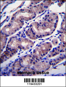 FOXA2 Antibody (Center)