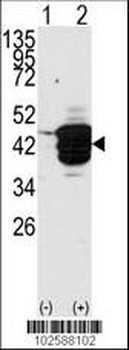 HDAC11 Antibody (N-term)