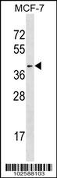 HDAC11 Antibody (N-term)