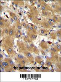 HPR Antibody (Center)