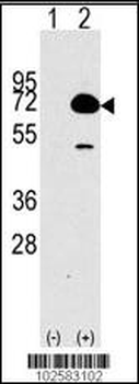 HDAC10 Antibody (N-term)