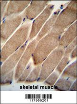 ELMO2 Antibody (Center)