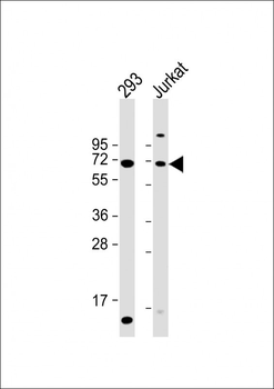 CYP2B6 Antibody (Center)