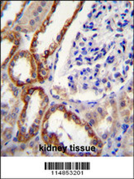 PARS2 Antibody (C-term)