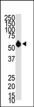 HDAC8 Antibody (N-term)