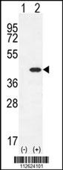 CLEC11A Antibody (Center)
