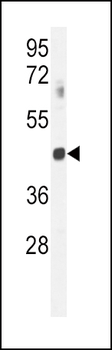 GNAT2 Antibody (Center)
