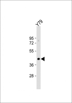 GNAT2 Antibody (Center)