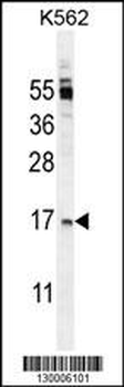 TNFSF4 Antibody (Center)