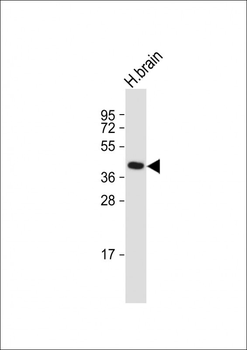 GFRAL Antibody (C-term)