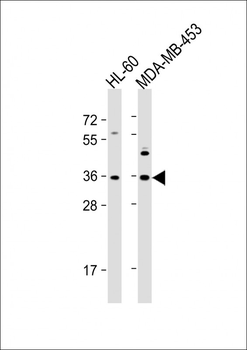 OR1J4 Antibody (C-term)