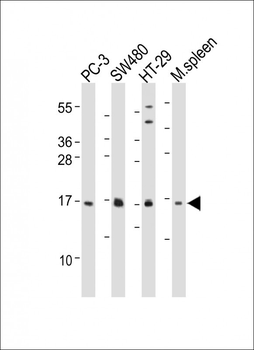 IFITM5 Antibody (Center)